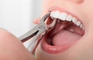 Боль после удаления зуба