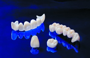 Как ухаживать за зубами из металлокерамики