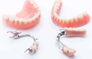 Какие бывают виды зубных протезов
